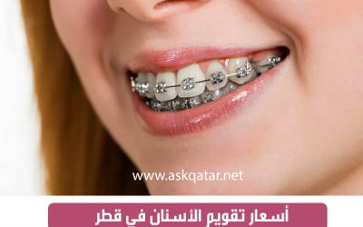 أسعار تقويم الأسنان في قطر