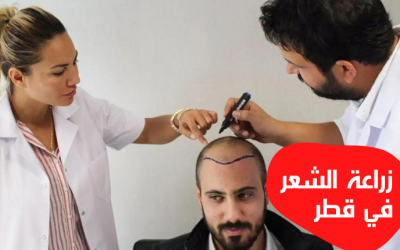 زراعة الشعر في قطر، خطوات زرع الشعر والأشخاص المرشحون لها